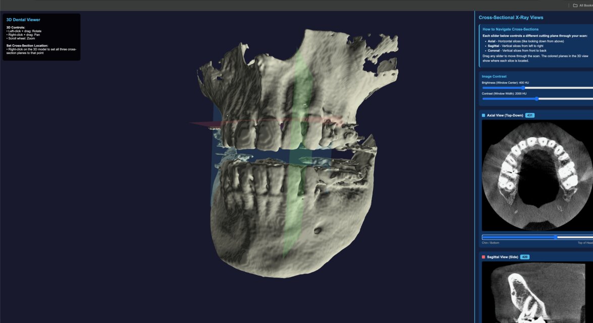 CT Viewer with 3D jaw model and cross-sectional views
